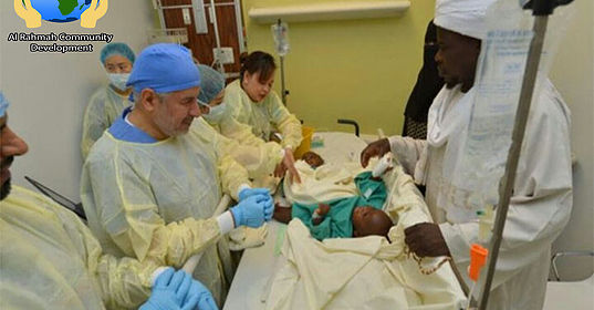 Conjoined Twins: Incredible story of Miracle and Testimony